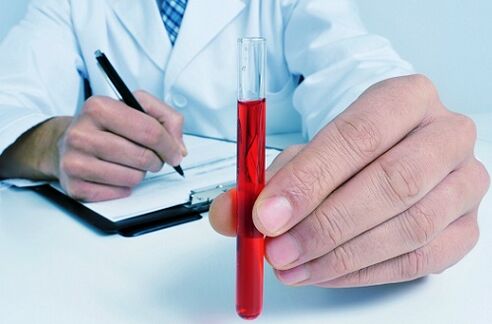 test sanguin pour identifier les parasites