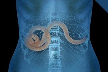 Parasites dans le corps humain