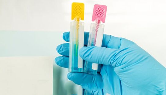 Méthodes de diagnostic parasite