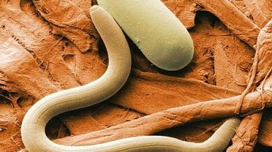 Parasites dans le corps humain