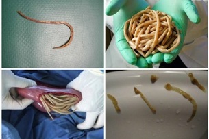 quels parasites peuvent vivre dans l'intestin humain